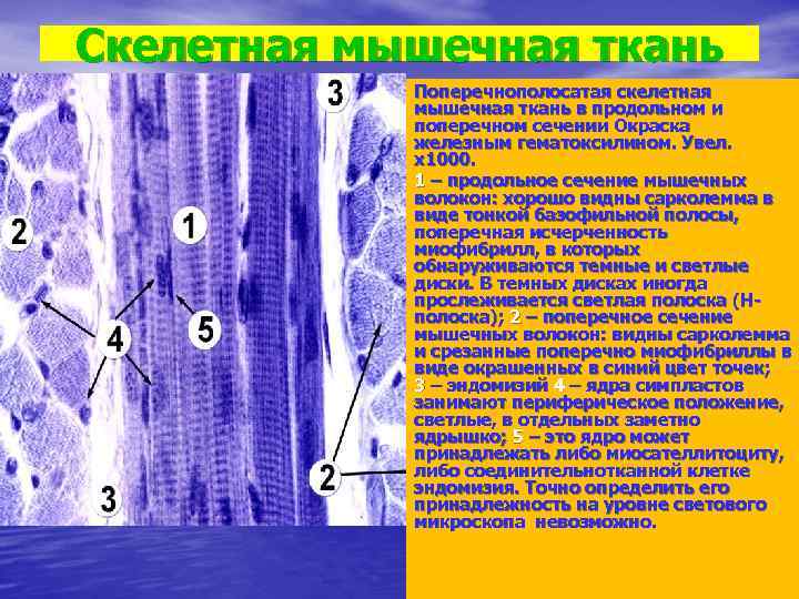 Скелетно поперечная ткань. Поперечнополосатая мышечная ткань гистология препарат. Поперечно-полосатая мышечная ткань языка Железный гематоксилин.