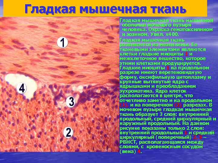 Гладкая мышечная ткань мышечной оболочки мочевого пузыря человека. Окраска гематоксилином и эозином. Увел. х400.