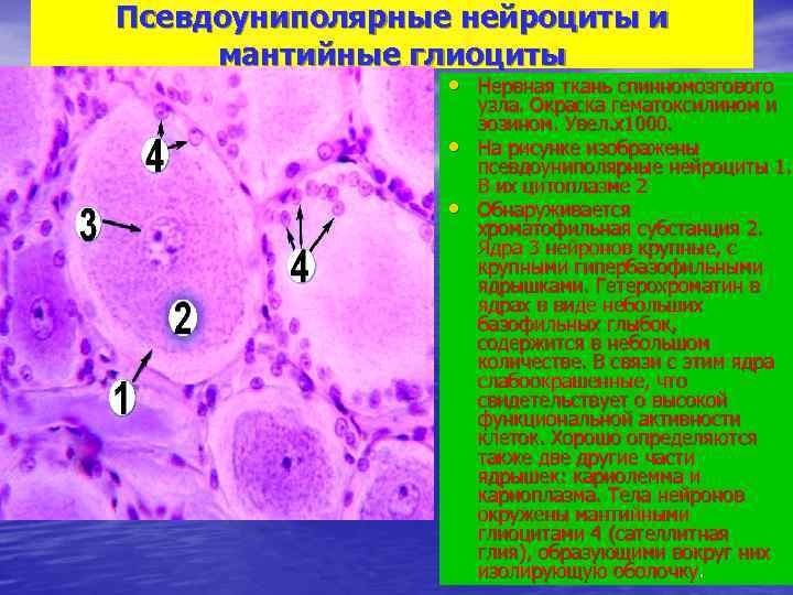 Нейроцит. Нейроциты препарат гистология. Псевдоуниполярные нервные клетки. Псевдоуниполярные нейроциты спинномозгового узла. Псевдоуниполярные Нейроны гематоксилин эозин.