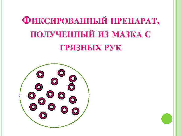 ФИКСИРОВАННЫЙ ПРЕПАРАТ, ПОЛУЧЕННЫЙ ИЗ МАЗКА С ГРЯЗНЫХ РУК 