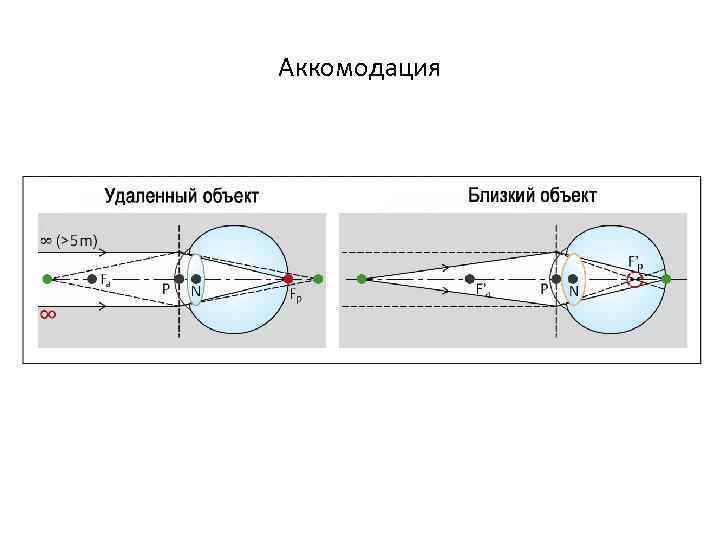 Аккомодация 