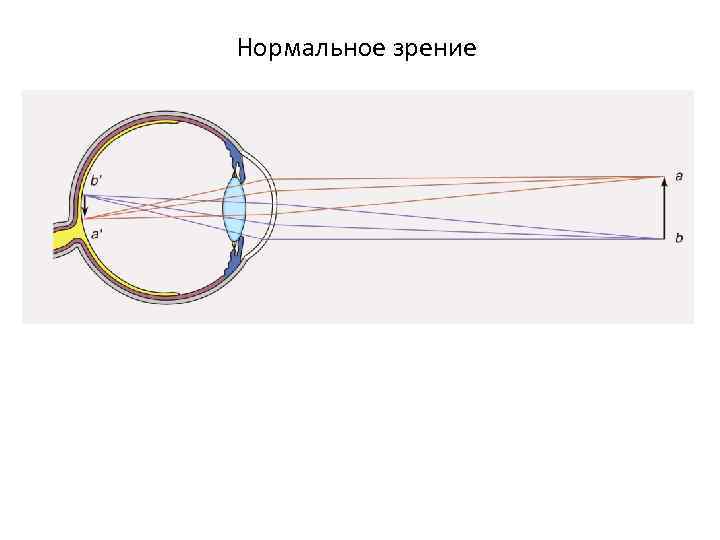 Нормальное зрение. Нормальное зрение эмметропия. Диоптрии физиология зрительного. Физиология зрения при нормальном зрении.