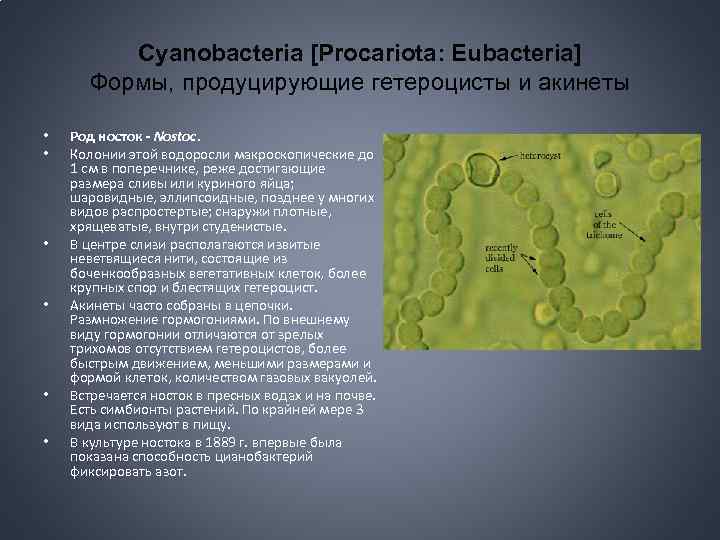 Группы организмов цианобактерии. Носток цианобактерия. Акинеты цианобактерий. Синезелёные водоросли цианобактерии. Акинеты ностока.