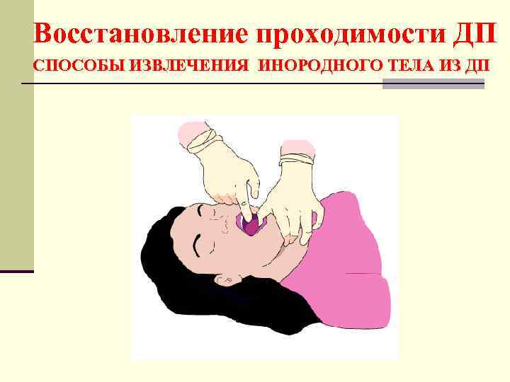 Восстановление проходимости ДП СПОСОБЫ ИЗВЛЕЧЕНИЯ ИНОРОДНОГО ТЕЛА ИЗ ДП 