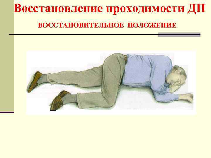 Восстановление проходимости ДП ВОССТАНОВИТЕЛЬНОЕ ПОЛОЖЕНИЕ 