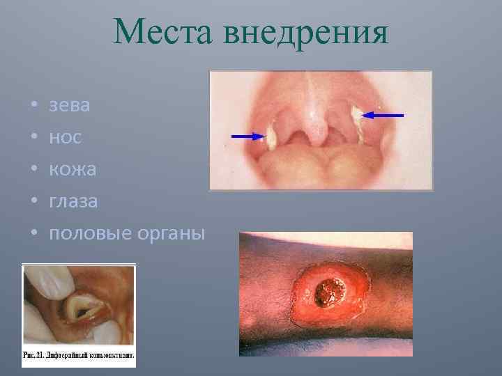 Места внедрения • • • зева нос кожа глаза половые органы 