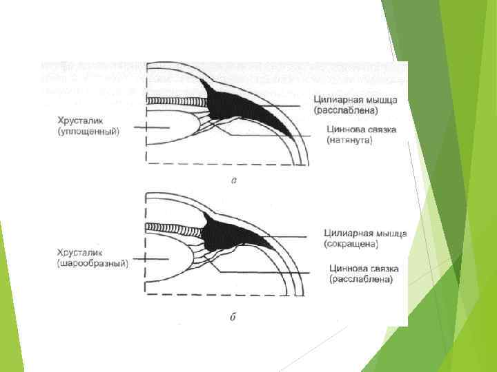 1 хрусталик. Механизм изменения кривизны хрусталика. При сокращении цилиарной мышцы кривизна хрусталика. Циннова связка хрусталика. Аккомодация глаза циннова связка.