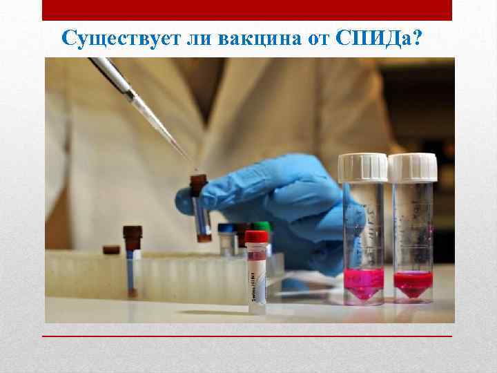 Существует ли вакцина от СПИДа? 