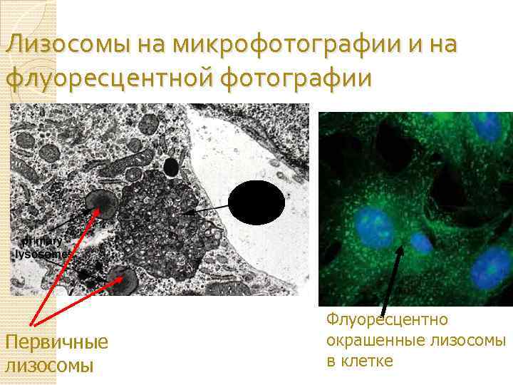 Лизосомы на микрофотографии и на флуоресцентной фотографии Первичные лизосомы Флуоресцентно окрашенные лизосомы в клетке