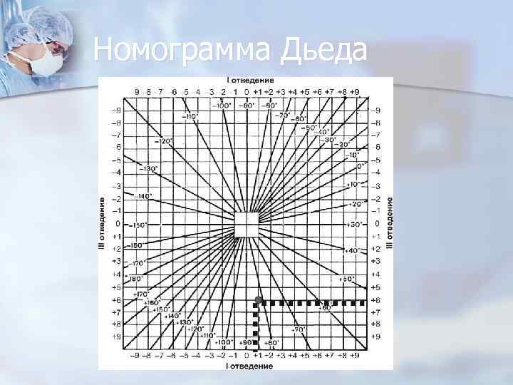 Номограмма Дьеда 