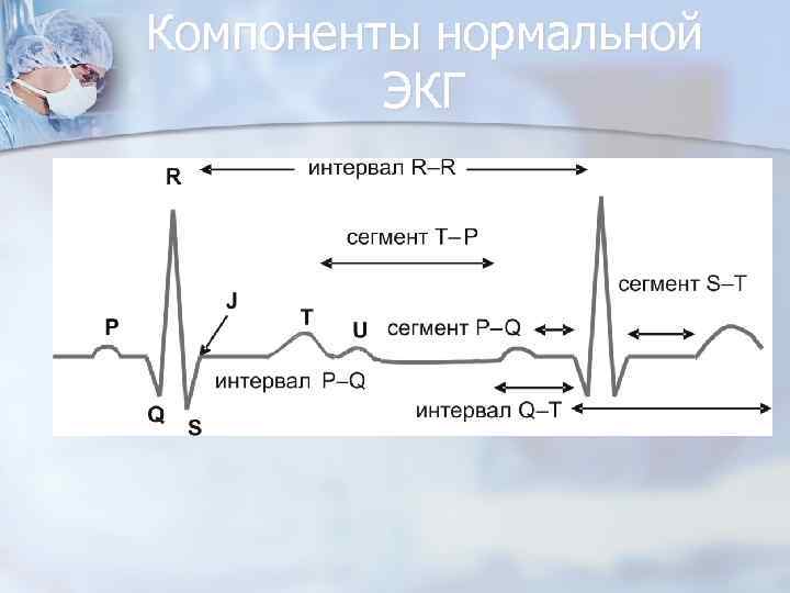 Компоненты нормальной ЭКГ 