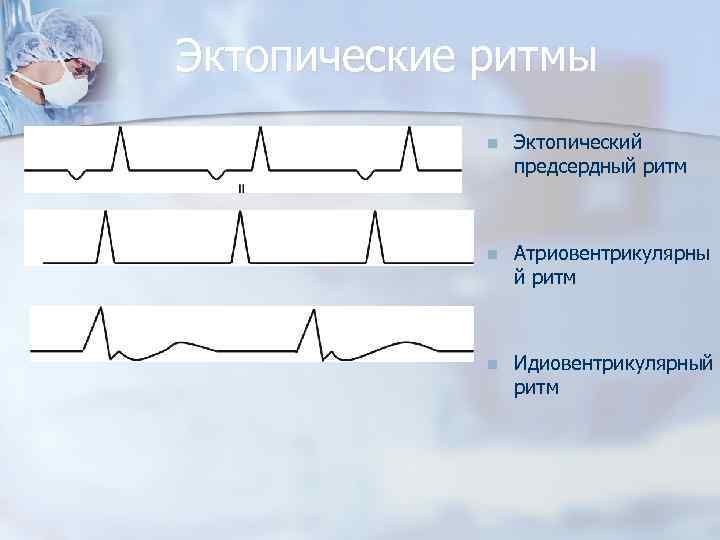 Эктопические ритмы n Эктопический предсердный ритм n Атриовентрикулярны й ритм n Идиовентрикулярный ритм 