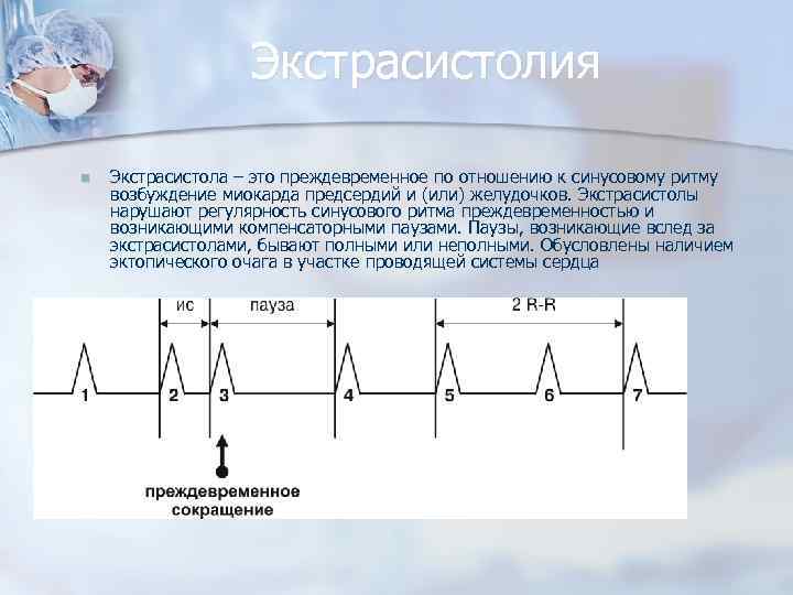 Экстрасистолия n Экстрасистола – это преждевременное по отношению к синусовому ритму возбуждение миокарда предсердий