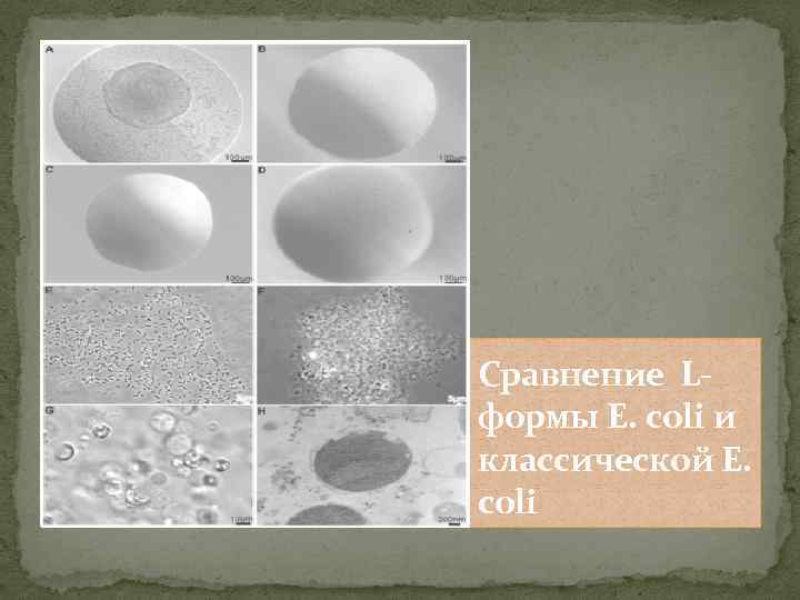 Сравнение Lформы E. coli и классической E. coli 