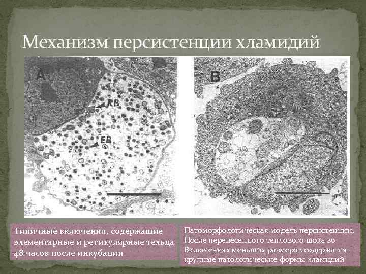 Механизм персистенции хламидий Типичные включения, содержащие элементарные и ретикулярные тельца 48 часов после инкубации