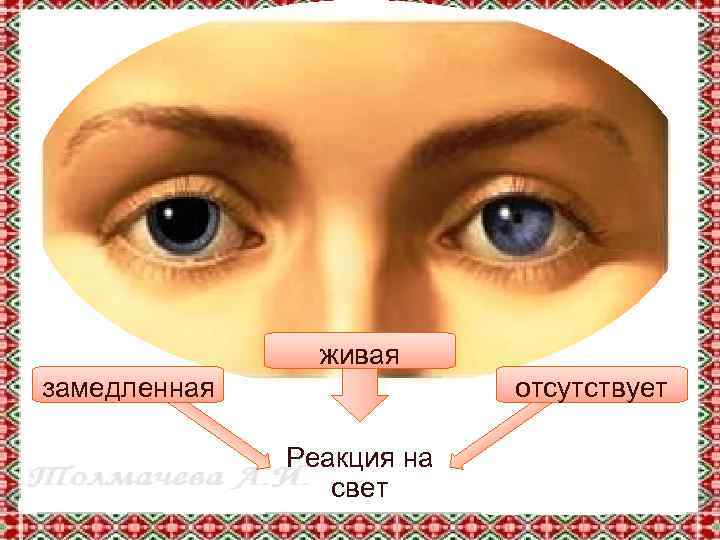 живая замедленная отсутствует Реакция на свет 