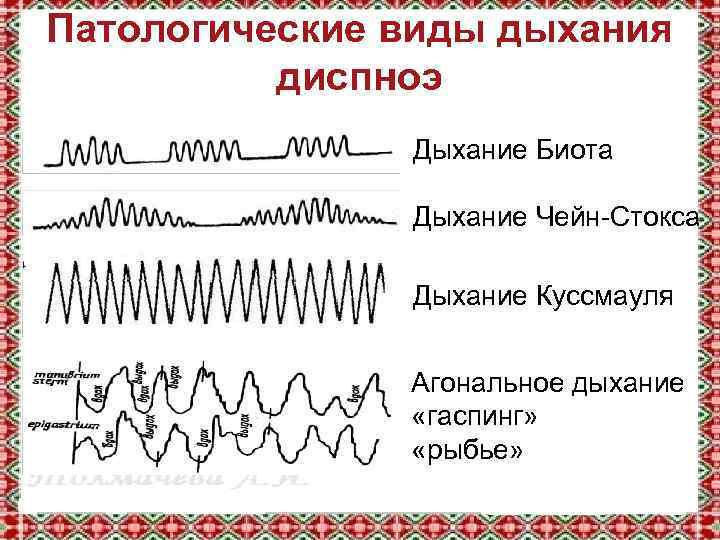 Патологические виды дыхания диспноэ Дыхание Биота Дыхание Чейн-Стокса Дыхание Куссмауля Агональное дыхание «гаспинг» «рыбье»