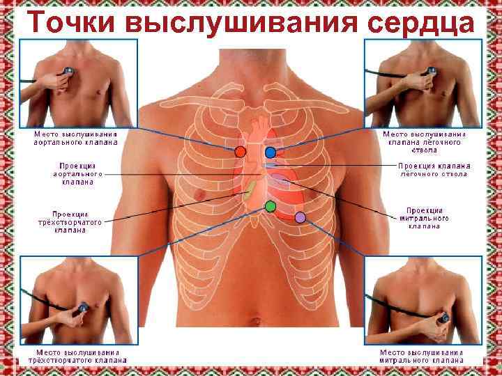 Точки выслушивания сердца 