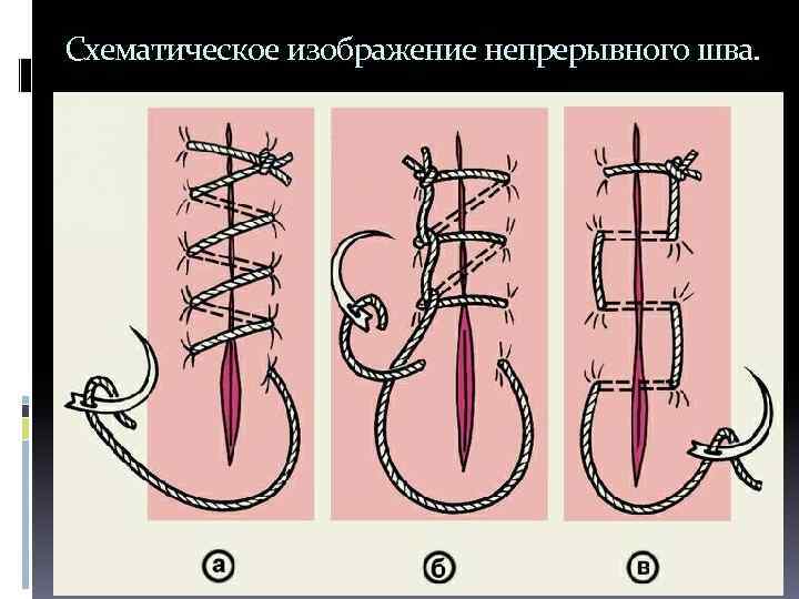 Схематическое изображение непрерывного шва. 