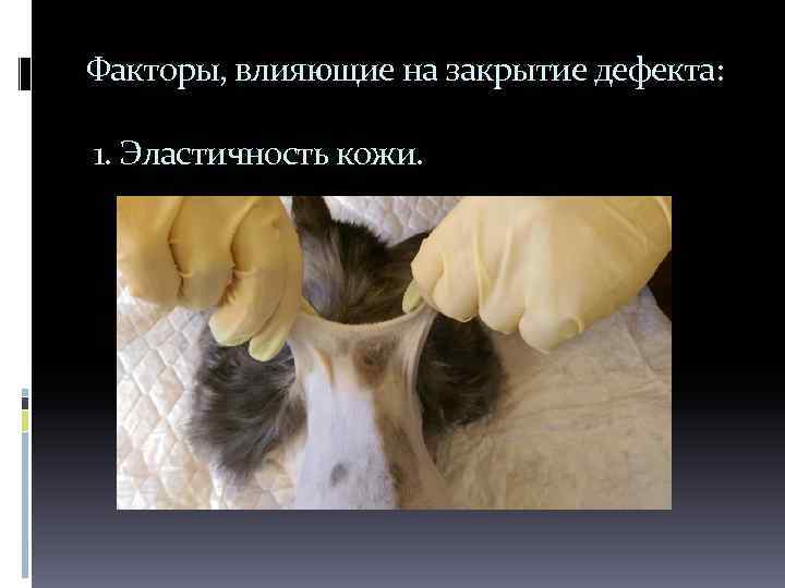 Факторы, влияющие на закрытие дефекта: 1. Эластичность кожи. 