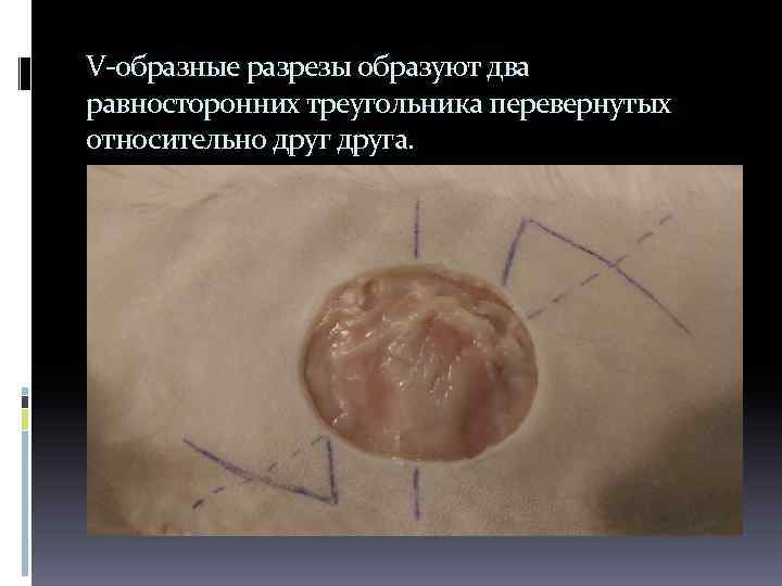 V-образные разрезы образуют два равносторонних треугольника перевернутых относительно друга. 