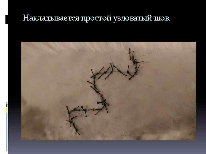 Накладывается простой узловатый шов. 