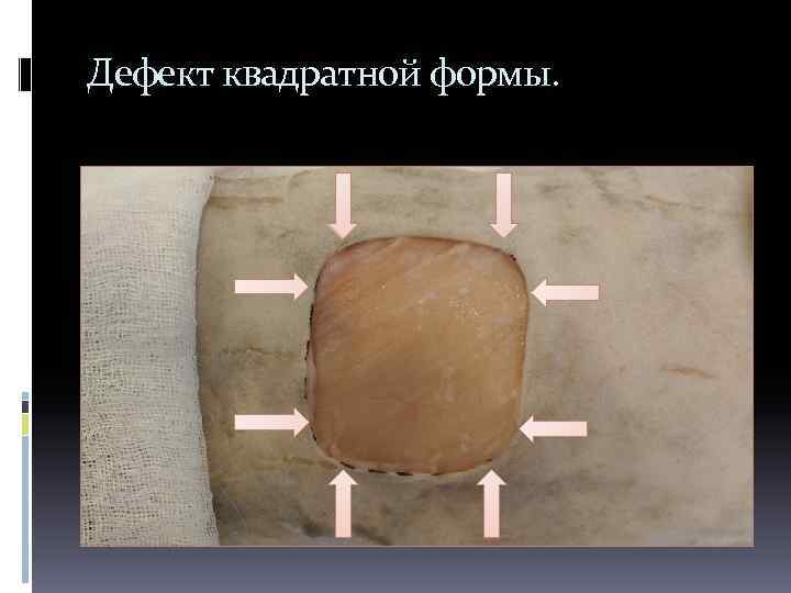 Дефект квадратной формы. 