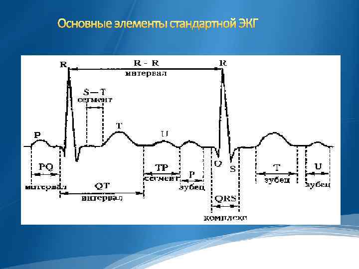 Основные элементы стандартной ЭКГ 