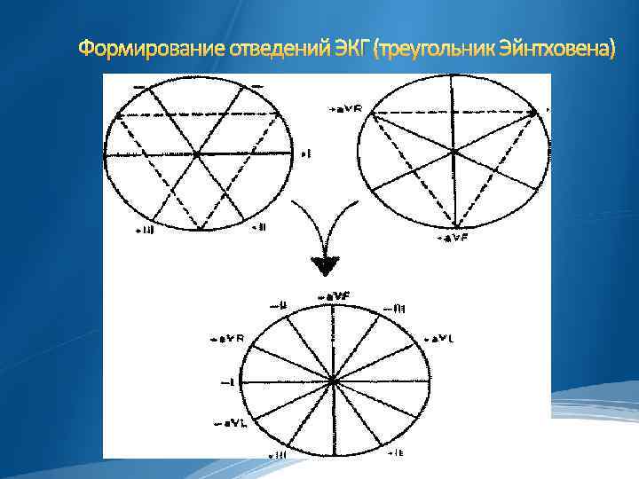 Формирование отведений ЭКГ (треугольник Эйнтховена) 