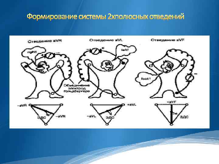 Обозначение зубцов экг p q r s t ввел