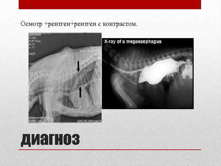 Осмотр +рентген с контрастом. диагноз 