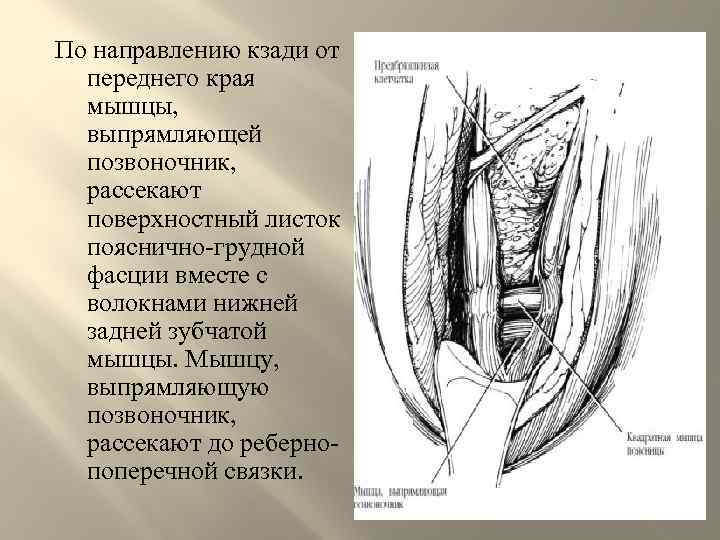 По направлению кзади от переднего края мышцы, выпрямляющей позвоночник, рассекают поверхностный листок пояснично-грудной фасции