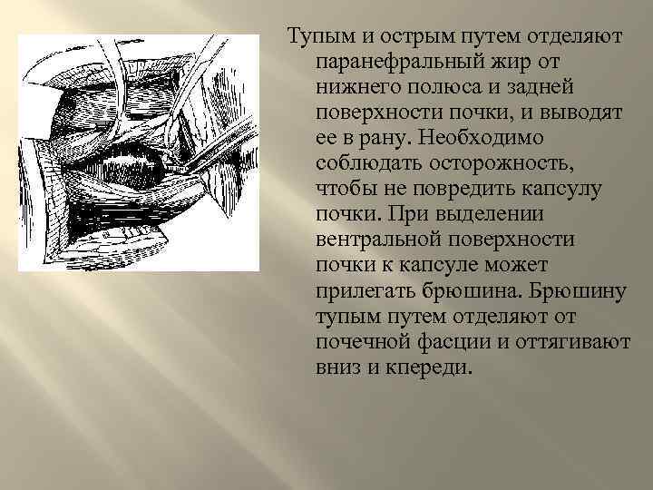 Тупым и острым путем отделяют паранефральный жир от нижнего полюса и задней поверхности почки,