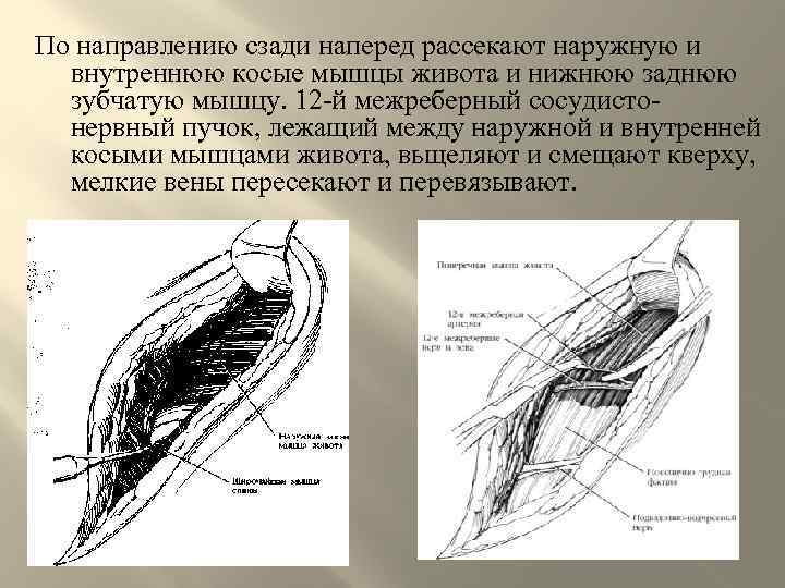 По направлению сзади наперед рассекают наружную и внутреннюю косые мышцы живота и нижнюю заднюю