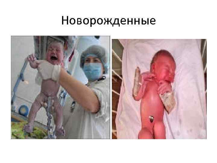 Новорожденные 