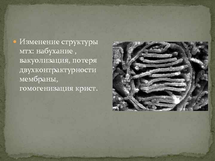  Изменение структуры мтх: набухание , вакуолизация, потеря двухконтрактурности мембраны, гомогенизация крист. 