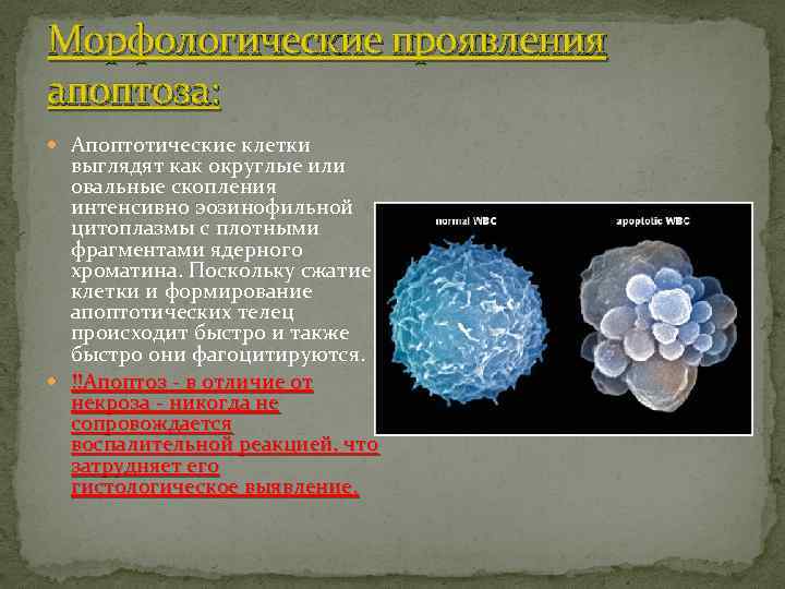 Морфологические проявления апоптоза: Апоптотические клетки выглядят как округлые или овальные скопления интенсивно эозинофильной цитоплазмы