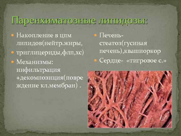 Паренхиматозные липидозы: Накопление в цпм липидов(нейтр. жиры, триглицериды, флп, хс) Механизмы: инфильтрация +декомпозиция(повре ждение