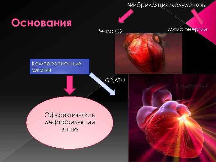 Фибрилляция желудочков Основания Мало O 2 Компрессионные сжатия O 2, АТФ Эффективность дефибрилляции выше