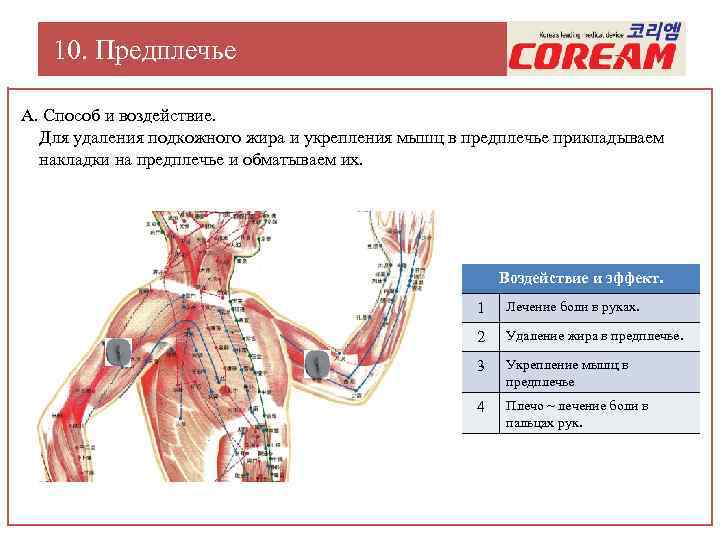 10. Предплечье А. Способ и воздействие. Для удаления подкожного жира и укрепления мышц в