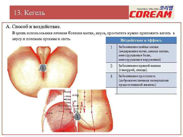 13. Кегель А. Способ и воздействие. В целях использования лечения болезни матки, ануса, простатита