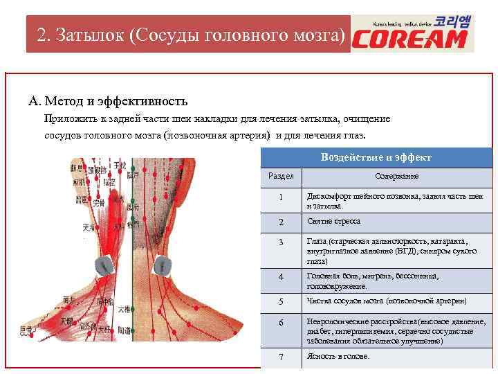 Бесшовное соединение сосудов метод а г коневского. Сосуды затылочной части.