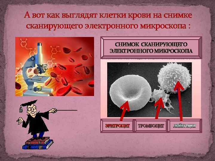 А вот как выглядят клетки крови на снимке сканирующего электронного микроскопа : СНИМОК СКАНИРУЮЩЕГО