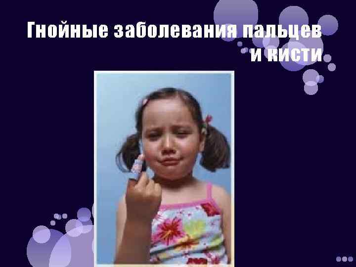 Гнойные заболевания пальцев и кисти 