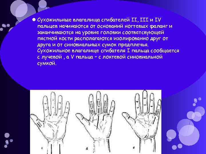  Сухожильные влагалища сгибателей II, III и IV пальцев начинаются от оснований ногтевых фаланг
