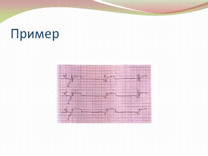 Пример 