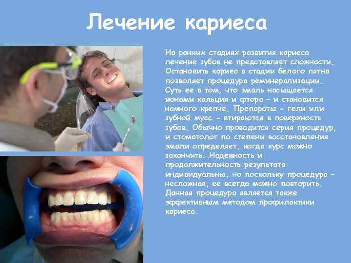 Лечение кариеса На ранних стадиях развития кариеса лечение зубов не представляет сложности. Остановить кариес