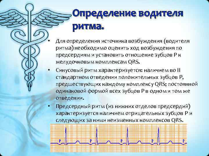 Определение водителя ритма. • Для определения источника возбуждения (водителя ритма) необходимо оценить ход возбуждения