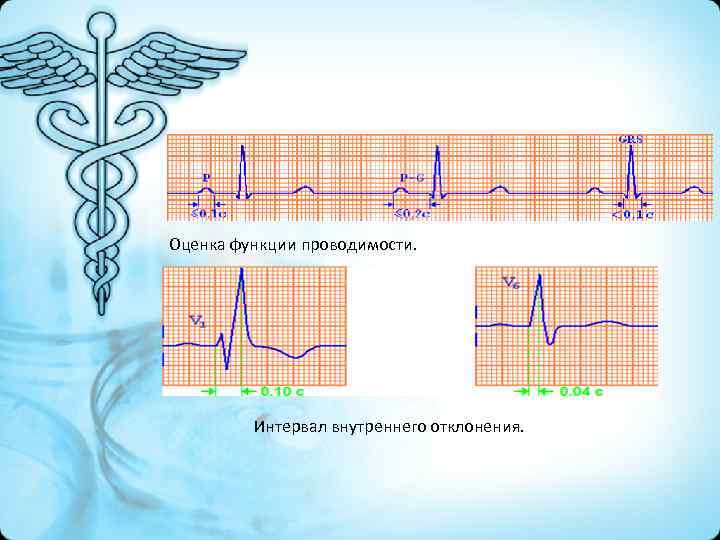 Проводимость на экг. Оценка проводимости на ЭКГ. Методы оценки проводимости сердца. Оценка функции проводимости. Электрокардиография функция проводимости.