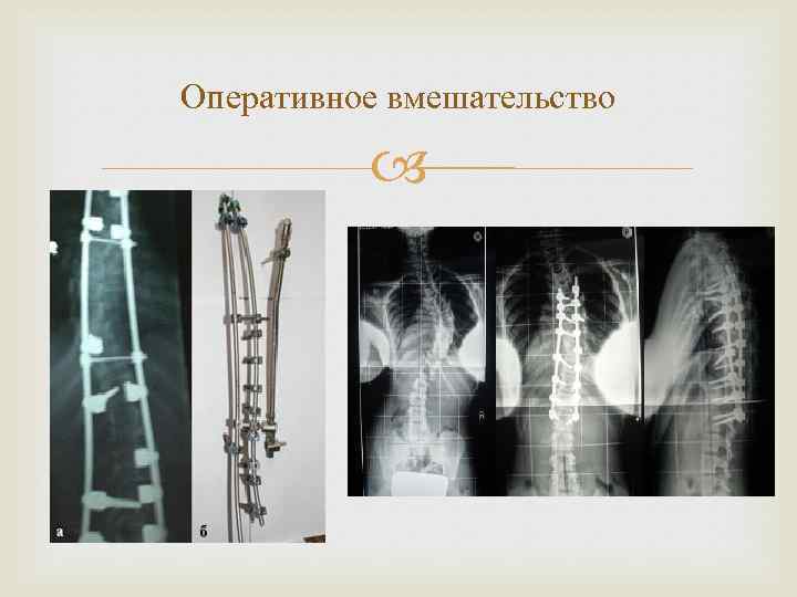 Оперативное вмешательство 